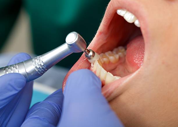 Best Wisdom Tooth Removal  in Derma, MS